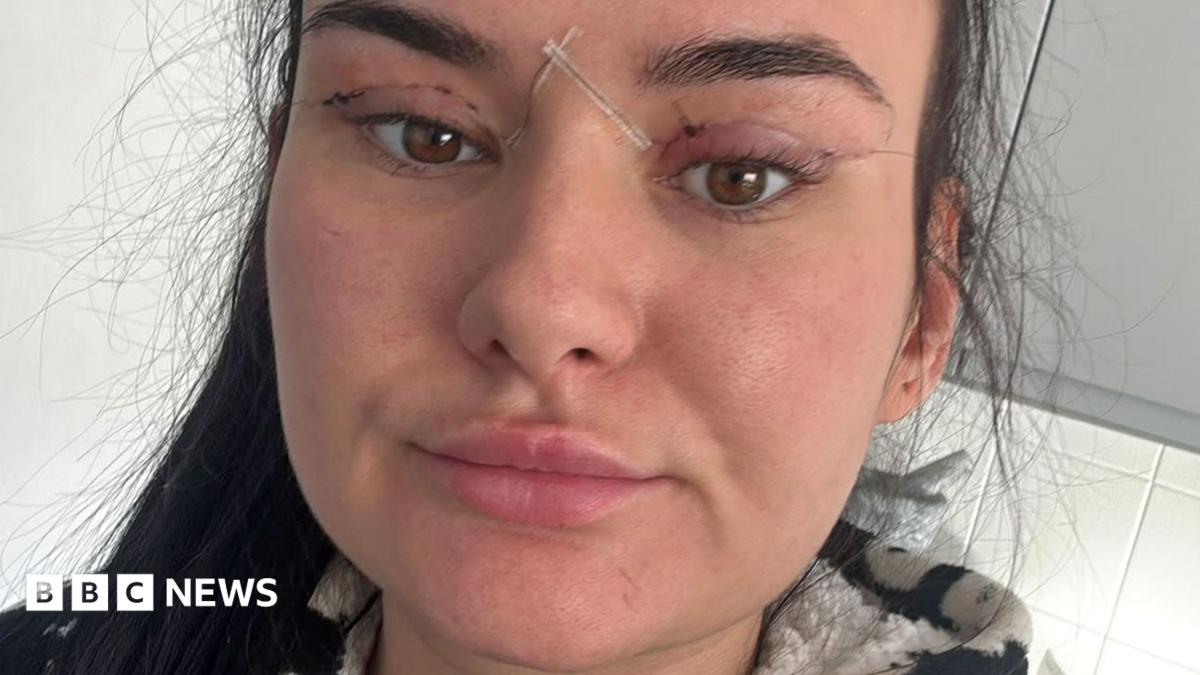 Open wounds and eyes that can't close - women warn about cheap bleph eyelid surgery
