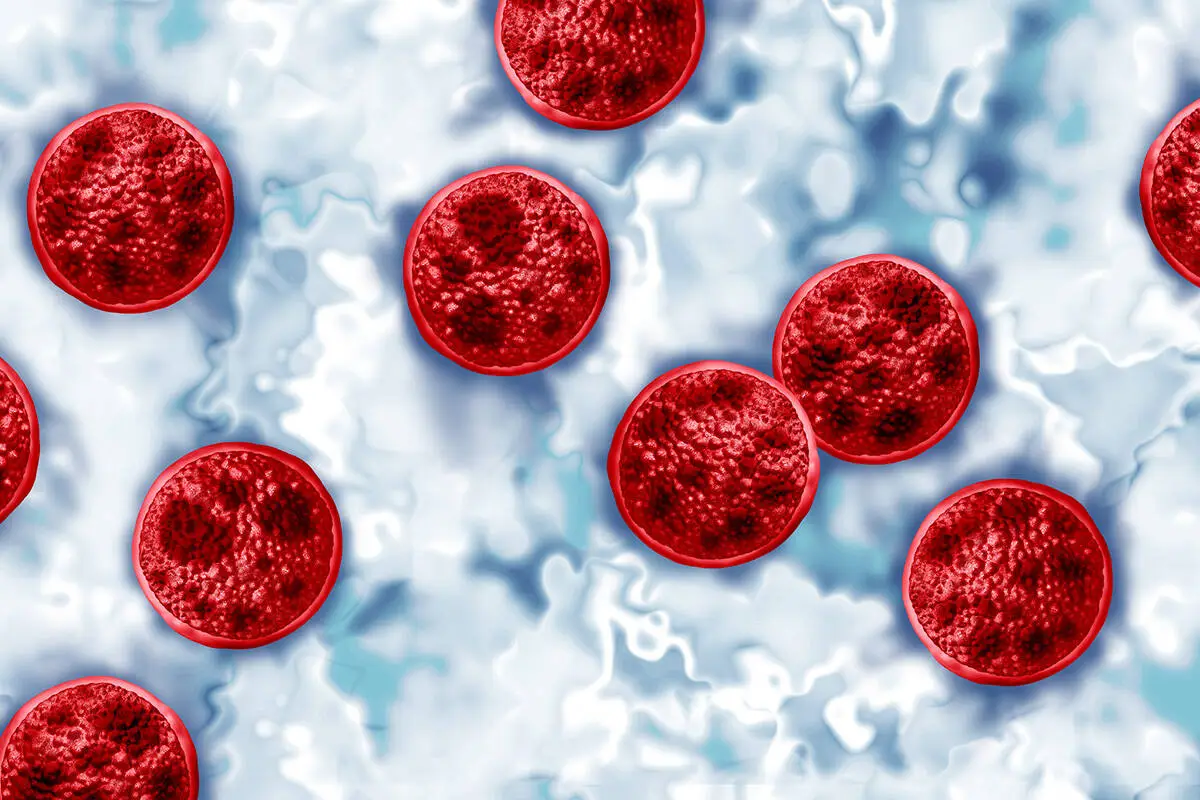Clark County reports another case of cyclosporiasis during nationwide outbreak