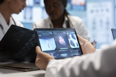 Before saying yes to a medical test, know the risks and benefits